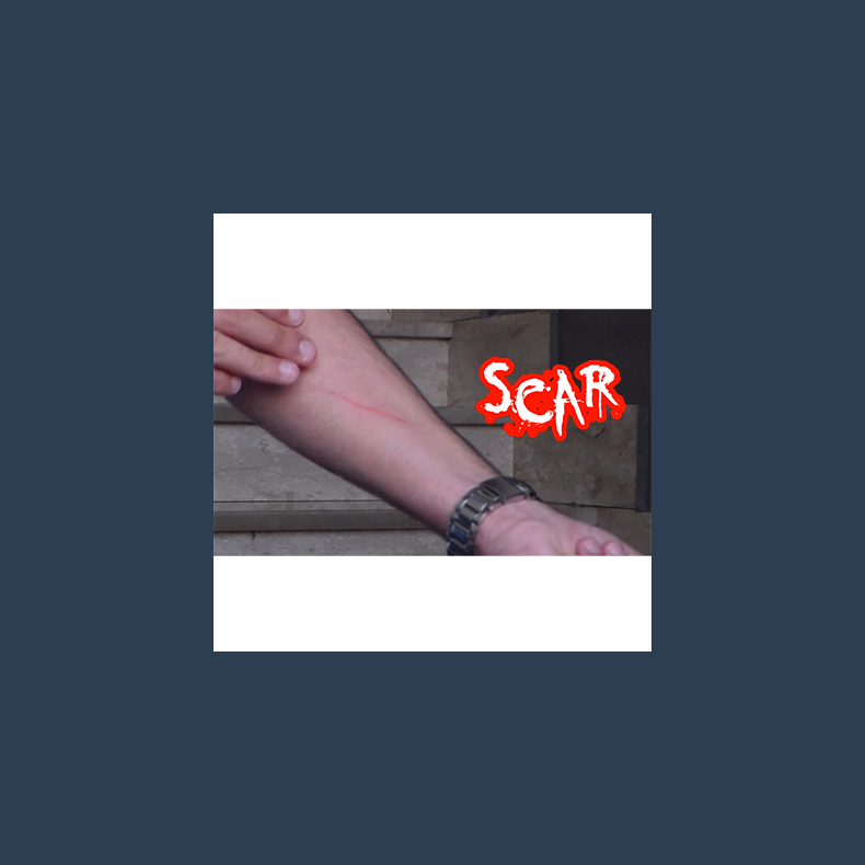 SCAR by Dan Alex - Video DOWNLOAD